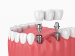 Discover the Future of Dentistry fortunesmilesdental